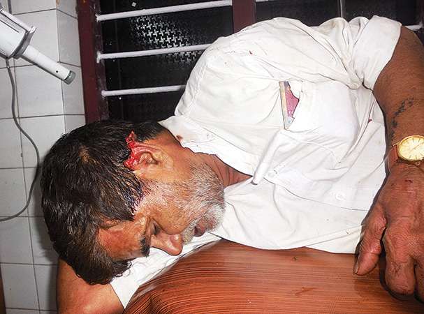 ತನ್ನ ಕಿವಿಗೆ ಕಚ್ಚಿದ ನಾಯಿಗೆ ಗತಿ ಕಾಣಿಸಿದ ಮಹಾಶಯ !